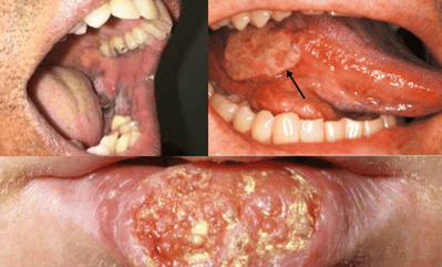 Oral Surgery